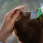 Head Lice logo